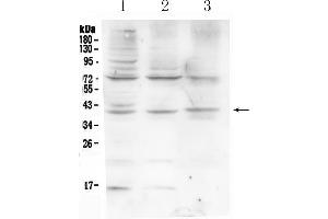 Western blot analysis of HFE using anti-HFE antibody . (HFE anticorps  (AA 82-199))