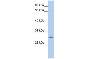 WB Suggested Anti-SCN1B Antibody Titration:  0.