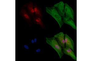 Phospho-NLRP6 (Ser109) Antibody staining A549 cells(4h of LPS treatment) by IF/ICC.