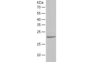 Western Blotting (WB) image for Regulatory Factor X-Associated Ankyrin Containing Protein (RFXANK) (AA 1-237) protein (His-IF2DI Tag) (ABIN7124821)
