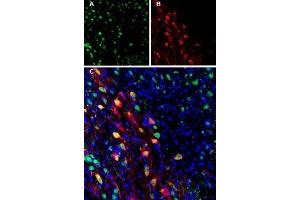 Expression of Ferroportin in mouse brain - Immunohistochemical staining of perfusion-fixed frozen mouse substantia nigra pars compacta (SNC) sections using Anti-Ferroportin (SLC40A1) Antibody (ABIN7043729, ABIN7044546 and ABIN7044547).