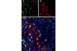 Expression of Ferroportin in mouse brain - Immunohistochemical staining of perfusion-fixed frozen mouse substantia nigra pars compacta (SNC) sections using Anti-Ferroportin (SLC40A1) Antibody (ABIN7043729, ABIN7044546 and ABIN7044547). (SLC40A1 anticorps  (2nd Cytoplasmic Loop))