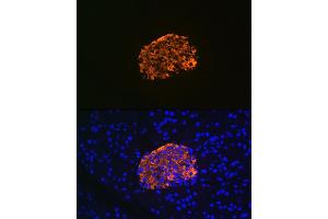 Immunofluorescence analysis of rat pancreas using IGFBP7 Rabbit mAb (ABIN7267910) at dilution of 1:100 (40x lens).