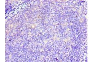 Immunohistochemistry of paraffin-embedded human tonsil tissue using ABIN7173940 at dilution of 1:100 (TWF2 anticorps  (AA 1-349))