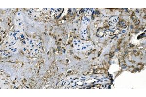 IHC analysis of Carbonic Anhydrase I/CA1 using anti-Carbonic Anhydrase I/CA1 antibody (ABIN7602621). (CA1 anticorps  (AA 9-261))