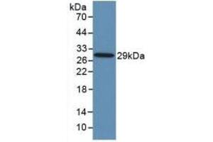 Detection of Recombinant TLR8, Human using Monoclonal Antibody to Toll Like Receptor 8 (TLR8) (TLR8 anticorps  (AA 844-1039))
