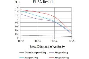 Black line: Control Antigen (100 ng),Purple line: Antigen (10 ng), Blue line: Antigen (50 ng), Red line:Antigen (100 ng)
