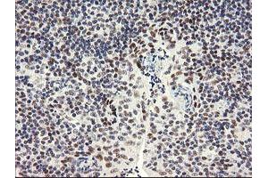 Image no. 4 for anti-SEC14 and Spectrin Domains 1 (SESTD1) antibody (ABIN1501066) (SESTD1 anticorps)