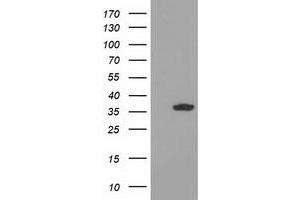 Western Blotting (WB) image for anti-Glyoxylate Reductase/hydroxypyruvate Reductase (GRHPR) antibody (ABIN1498520) (GRHPR anticorps)