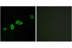 Immunofluorescence analysis of LOVO cells, using HTR5A Antibody. (Serotonin Receptor 5A anticorps  (AA 15-64))