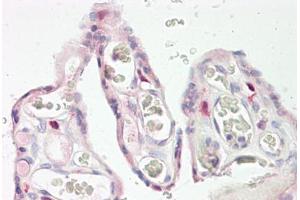 Image no. 2 for anti-Keratocan (KERA) (AA 196-245) antibody (ABIN1493172)