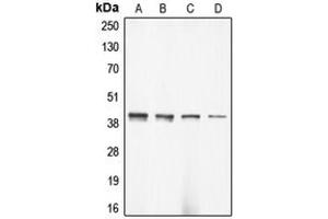 anti-Actin, gamma 2, Smooth Muscle, Enteric (ACTG2) (N-Term) antibody