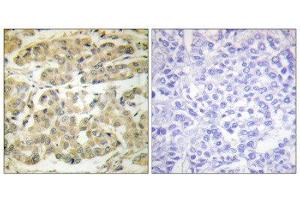 Immunohistochemistry (IHC) image for anti-14-3-3 zeta (YWHAZ) (pSer58) antibody (ABIN1847201) (14-3-3 zeta anticorps  (pSer58))