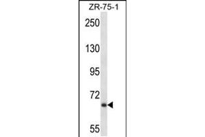 Western blot analysis in ZR-75-1 cell line lysates (35ug/lane). (Junctophilin 2 anticorps  (C-Term))