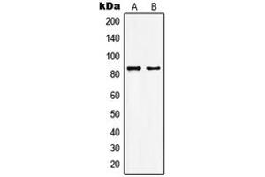 Western blot analysis of KAT7 expression in HepG2 (A), MCF7 (B) whole cell lysates. (MYST2 anticorps  (Center))