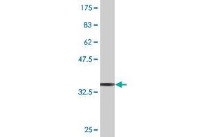 Western Blot detection against Immunogen (36. (AKAP5 anticorps  (AA 334-427))