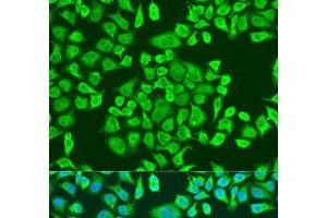 Immunofluorescence analysis of U2OS cells using IGF2BP3 Polyclonal Antibody at dilution of 1:100. (IGF2BP3 anticorps)