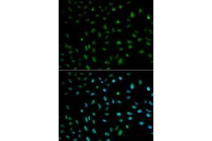 Immunofluorescence analysis of MCF-7 cells using ELAVL1 antibody (ABIN5970780). (ELAVL1 anticorps)