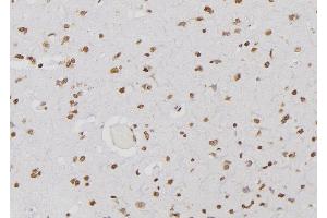ABIN6276644 at 1/100 staining Human brain tissue by IHC-P.