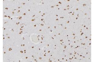 ABIN6276644 at 1/100 staining Human brain tissue by IHC-P.