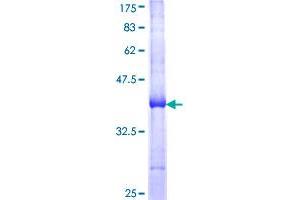 Image no. 1 for Mediterranean Fever (MEFV) (AA 1-110) protein (GST tag) (ABIN1310698)