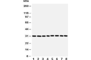 Western blot testing of VDAC1 antibody and Lane 1:  rat skeletal muscle;  2: (r) heart;  3: (r) liver; and human samples 4: HeLa;  5: A431;  6: A549;  7: SMMC-7721;  8: HT1080 cell lysate.