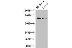 Western Blot Positive WB detected in: SH-SY5Y whole cell lysate, Mouse liver tissue All lanes: CHAT antibody at 3 μg/mL Secondary Goat polyclonal to rabbit IgG at 1/50000 dilution Predicted band size: 83, 75, 71 kDa Observed band size: 75 kDa (Choline Acetyltransferase anticorps  (AA 354-592))