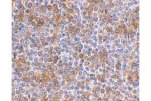 Immunohistochemical staining of human spleen using AP30069PU-N APOBEC3G antibody at 1 μg/ml. (APOBEC3G anticorps  (N-Term))