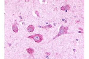 Immunohistochemical staining of Brain (Neurons) using anti- LPHN3 antibody ABIN122280 (LPHN3 anticorps  (Cytoplasmic Domain))
