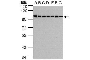 HPS3 antibody  (C-Term)
