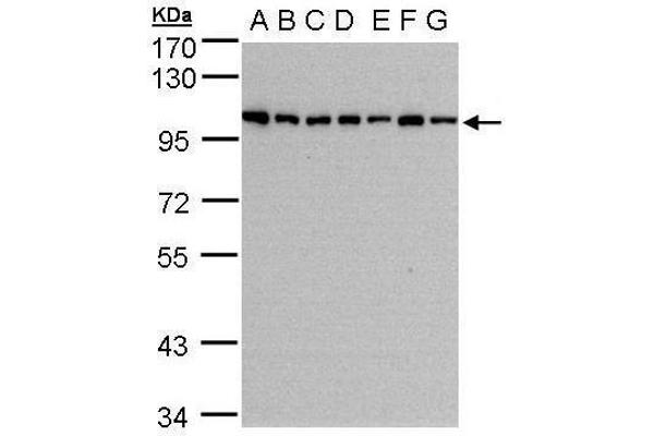 HPS3 anticorps  (C-Term)