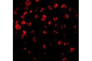 Immunofluorescence of IRAK2 in HeLa cells with AP30441PU-N IRAK antibody at 10 μg/ml. (IRAK2 anticorps  (C-Term))