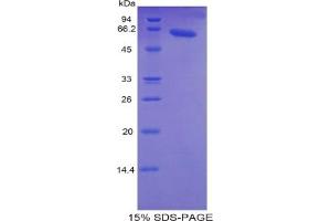 SDS-PAGE of Protein Standard from the Kit  (Highly purified E. (TNNC2 Kit ELISA)