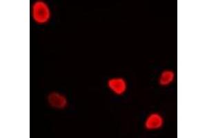 Immunofluorescent analysis of RFC4 staining in U2OS cells. (RFC4 anticorps)