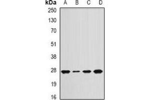 Western blot analysis of APC10 expression in Jurkat (A), mouse lung (B), mouse spleen (C), rat heart (D) whole cell lysates. (ANAPC10 anticorps)