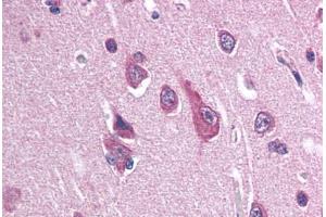 Human Brain, Cortex (formalin-fixed, paraffin-embedded) stained with SCN2B antibody ABIN337345 at 10-20 ug/ml followed by biotinylated goat anti-rabbit IgG secondary antibody ABIN481713, alkaline phosphatase-streptavidin and chromogen. (SCN2B anticorps  (N-Term))