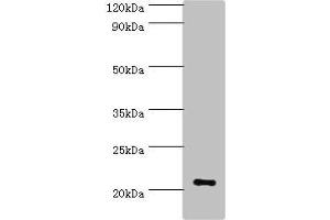 Western blot All lanes: ARF3 antibody at 6 μg/mL + Mouse brain tissue Secondary Goat polyclonal to rabbit IgG at 1/10000 dilution Predicted band size: 21, 17 kDa Observed band size: 21 kDa (ARF3 anticorps  (AA 1-181))