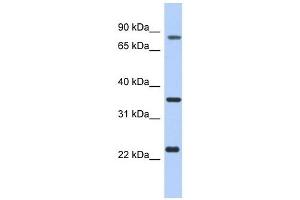 C17ORF82 antibody used at 1 ug/ml to detect target protein. (C17orf82 anticorps  (N-Term))