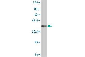 Western Blot detection against Immunogen (36. (IRAK2 anticorps  (AA 111-210))