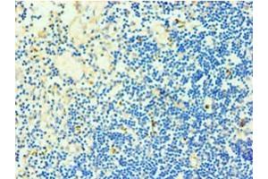 Immunohistochemistry of paraffin-embedded human thymus tissue using ABIN7173325 at dilution of 1:100 (TCOF1 anticorps  (AA 1189-1488))