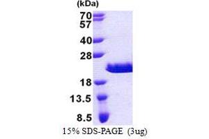 SDS-PAGE (SDS) image for RPA Interacting Protein (RPAIN) (AA 1-106) protein (His tag) (ABIN5853173)