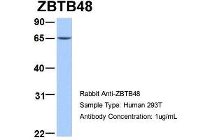 Human 293T; Host: Rabbit . (ZBTB48 anticorps  (N-Term))