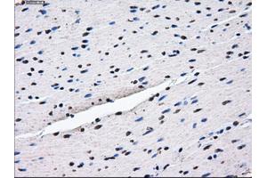 Immunohistochemical staining of paraffin-embedded endometrium tissue using anti-HDAC10mouse monoclonal antibody.