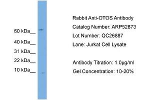 WB Suggested Anti-OTOS  Antibody Titration: 0.