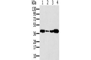 Gel: 12 % SDS-PAGE, Lysate: 40 μg, Lane 1-4: Human testis tissue, Human seminoma tissue, Jurkat cells, human liver cancer tissue, Primary antibody: ABIN7192710(SYCP3 Antibody) at dilution 1/200, Secondary antibody: Goat anti rabbit IgG at 1/8000 dilution, Exposure time: 40 seconds (SYCP3 anticorps)
