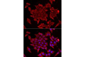 Immunofluorescence analysis of U2OS cells using TIMM17A antibody.