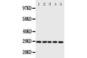 Western Blotting (WB) image for anti-Stratifin (SFN) (AA 140-156), (Middle Region) antibody (ABIN3044182) (14-3-3 sigma/SFN anticorps  (Middle Region))