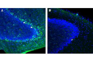 Expression of FLRT3 in mouse cerebellum.