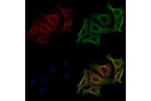 ABIN6256614 and ABIN6267490 staining HepG2 cells(4h of LPS treatment) by IF/ICC.
