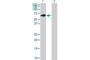 Western Blot analysis of ZIM2 expression in transfected 293T cell line by ZIM2 MaxPab polyclonal antibody. (ZIM2 anticorps  (AA 1-527))